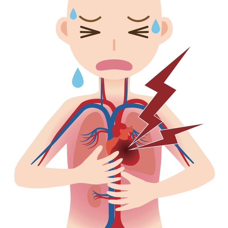 Can Stem Cell Treatments Aid in Recovery from a Heart Attack?